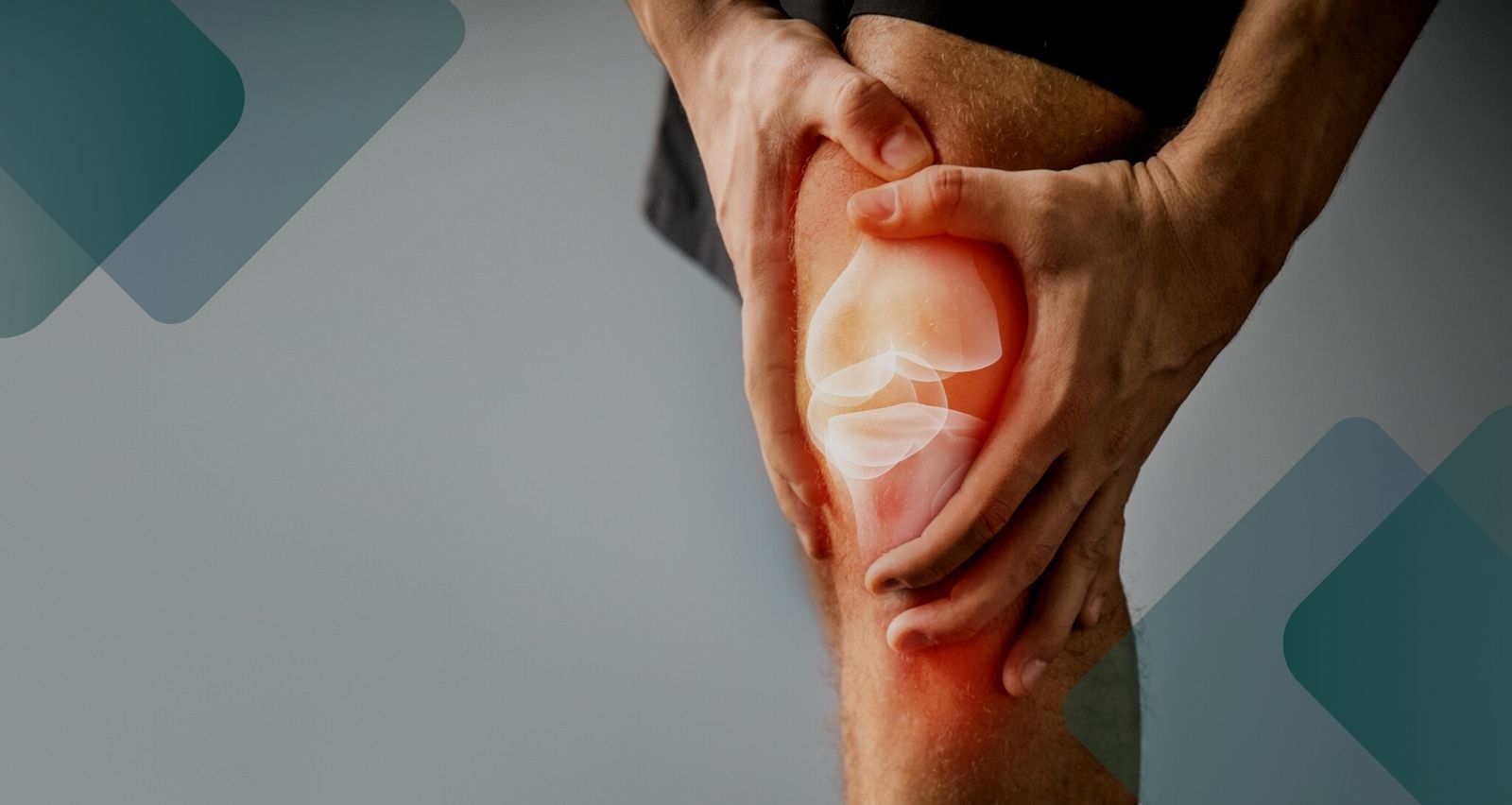 Leia mais sobre o artigo Como funciona a fisioterapia para quem rompeu o ligamento do joelho?